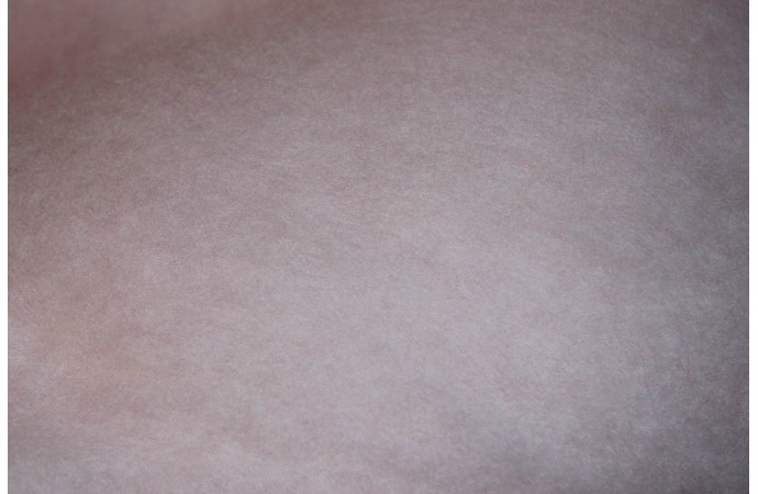 Sakuras krāsas kārsums