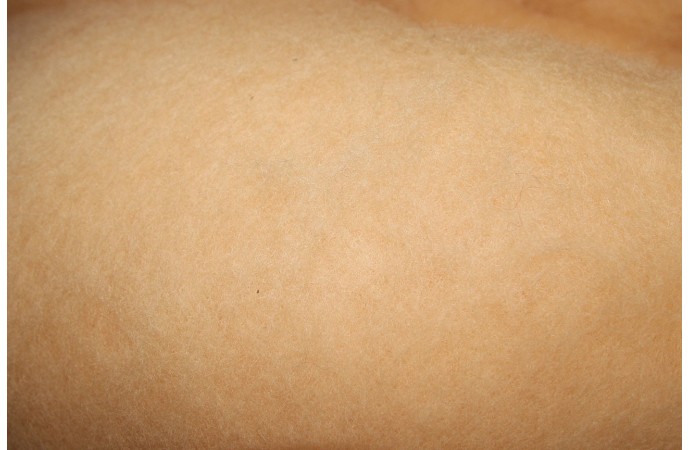 Smilšu krāsas kārsums